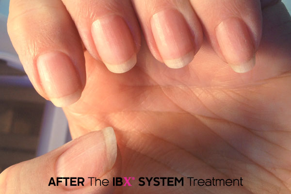 ibx nail repair photo